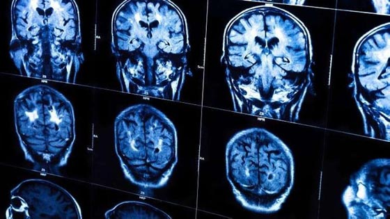 الذكاء العلمي والنجاح المهني تزيد من احتمال الاصابة بامراض خطيرة صورة رقم 1