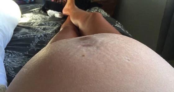 فيديو مثير.. ركلات جنين مخيفة داخل بطن امه بحيث تبرز ساقه من بطنها صورة رقم 1 فيديو مثير.. ركلات جنين مخيفة داخل بطن امه بحيث تبرز ساقه من بطنها صورة رقم 1