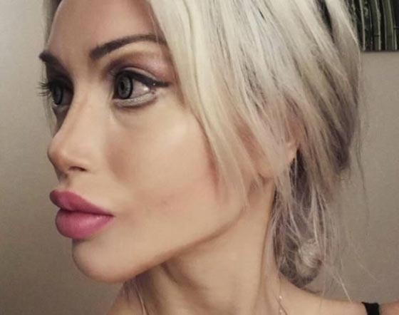 عارضة ازياء تخضع لـ 200 عملية تجميل فهل اصبحت مثالية؟! صورة رقم 1 عارضة ازياء تخضع لـ 200 عملية تجميل فهل اصبحت مثالية؟! صورة رقم 1