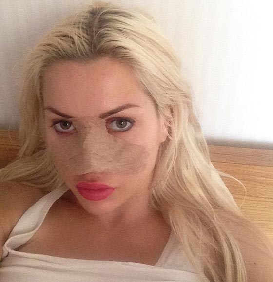 عارضة ازياء تخضع لـ 200 عملية تجميل فهل اصبحت مثالية؟! صورة رقم 6 عارضة ازياء تخضع لـ 200 عملية تجميل فهل اصبحت مثالية؟! صورة رقم 6