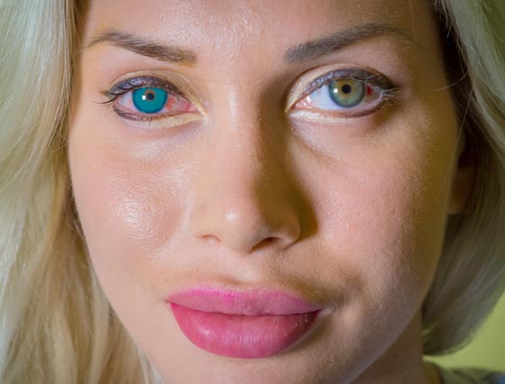 عارضة ازياء تخضع لـ 200 عملية تجميل فهل اصبحت مثالية؟! صورة رقم 8 عارضة ازياء تخضع لـ 200 عملية تجميل فهل اصبحت مثالية؟! صورة رقم 8