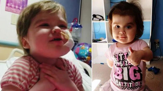 شاهدوا ماذا فعلت طفلة تعاني من مرض نادر عند مغادرتها المستشفى صورة رقم 2