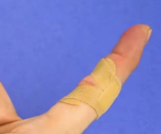 ليس كما تتوقعون.. الطريقة الصحيحة لوضع اللاصق الطبي.. فيديو صورة رقم 3