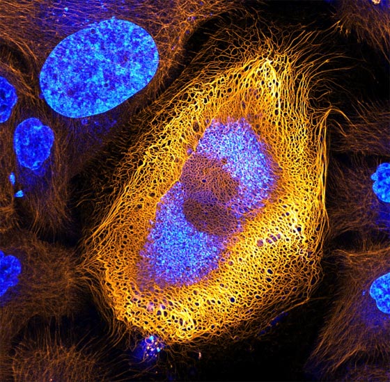 أروع الصور المجهرية وأكثرها إثارة للإعجاب على الإطلاق! صورة رقم 1