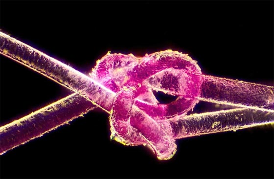 أروع الصور المجهرية وأكثرها إثارة للإعجاب على الإطلاق! صورة رقم 13