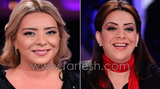 بالصور.. هؤلاء النجمات العرب قبل وبعد عمليات التجميل صورة رقم 1