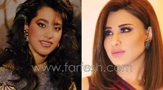 بالصور.. هؤلاء النجمات العرب قبل وبعد عمليات التجميل صورة رقم 3