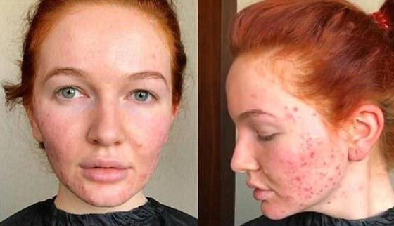 صدق أو لا تصدق.. فنانة تجميل تحول مرضى السرطان إلى ملكات جمال رائعات! صورة رقم 1
