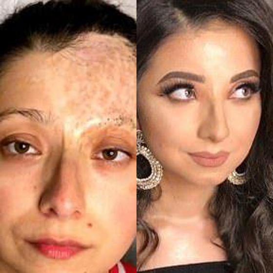 صدق أو لا تصدق.. فنانة تجميل تحول مرضى السرطان إلى ملكات جمال رائعات! صورة رقم 3