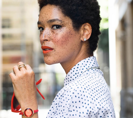 6 اشخاص جذبوا انتباه العالم بلون البشرة غير المألوف صورة رقم 1