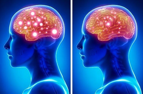 البوظة والرجيم.. أسباب غير متوقعة تؤدي إلى أضرار المخ صورة رقم 5