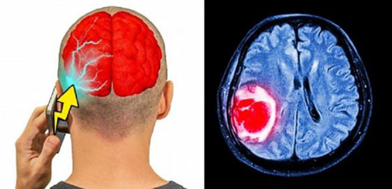 البوظة والرجيم.. أسباب غير متوقعة تؤدي إلى أضرار المخ صورة رقم 7