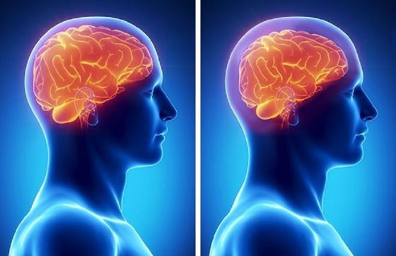 البوظة والرجيم.. أسباب غير متوقعة تؤدي إلى أضرار المخ صورة رقم 10