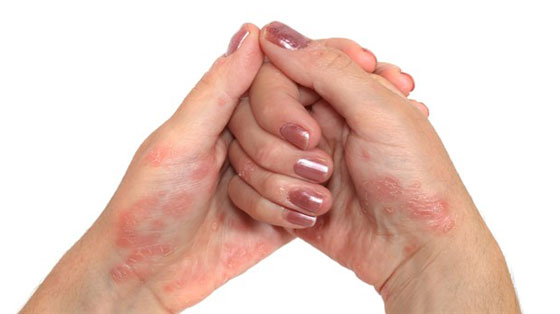 يعالج الكثير من الامراض.. هذا تفعله بك فصوص قليلة من الثوم! صورة رقم 4