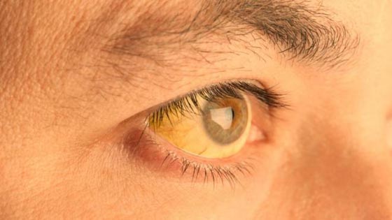 شكل الوجه مرآة للصحة.. 7 علامات تظهر على الوجه تكشف عن أمراض صورة رقم 2