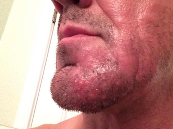 شكل الوجه مرآة للصحة.. 7 علامات تظهر على الوجه تكشف عن أمراض صورة رقم 6
