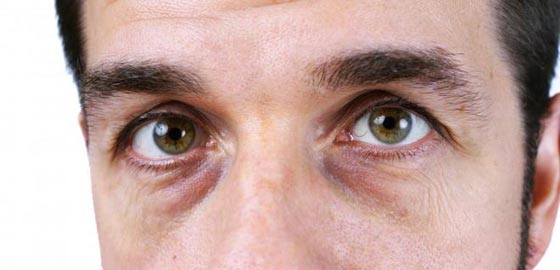 شكل الوجه مرآة للصحة.. 7 علامات تظهر على الوجه تكشف عن أمراض صورة رقم 3
