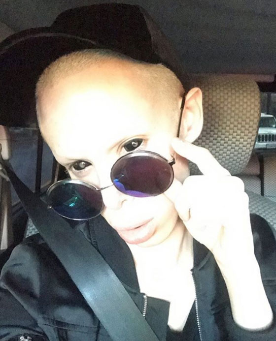 جنون عمليات التجميل.. شاب ينفق الاف الدولارات ليتحول لكائن فضائي  صورة رقم 13