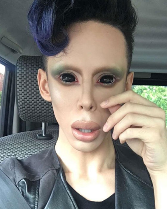 جنون عمليات التجميل.. شاب ينفق الاف الدولارات ليتحول لكائن فضائي  صورة رقم 7
