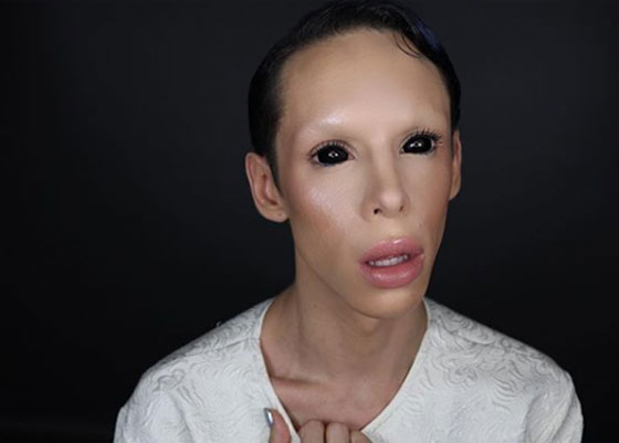 جنون عمليات التجميل.. شاب ينفق الاف الدولارات ليتحول لكائن فضائي  صورة رقم 9