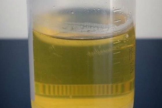 أغرب 10 اختبارات قديمة لكشف الحمل منها البصل والكلور وعيني المرأة! صورة رقم 7