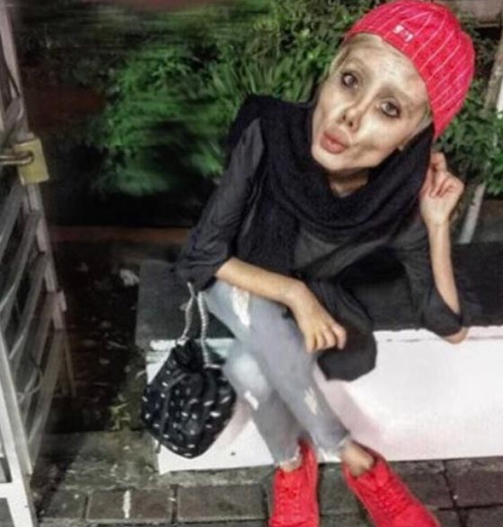 سحر تبر الإيرانية شبيهة انجلينا جولي تكشف سر ال50 عملية تجميل! صورة رقم 5 سحر تبر الإيرانية شبيهة انجلينا جولي تكشف سر ال50 عملية تجميل! صورة رقم 5