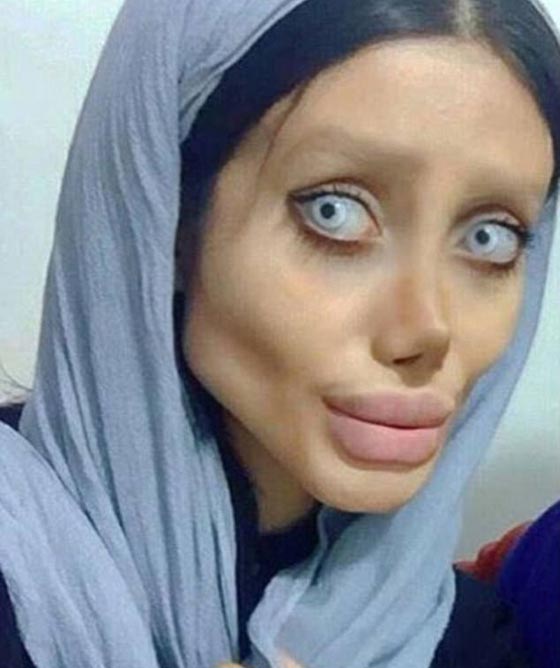 سحر تبر الإيرانية شبيهة انجلينا جولي تكشف سر ال50 عملية تجميل! صورة رقم 8 سحر تبر الإيرانية شبيهة انجلينا جولي تكشف سر ال50 عملية تجميل! صورة رقم 8