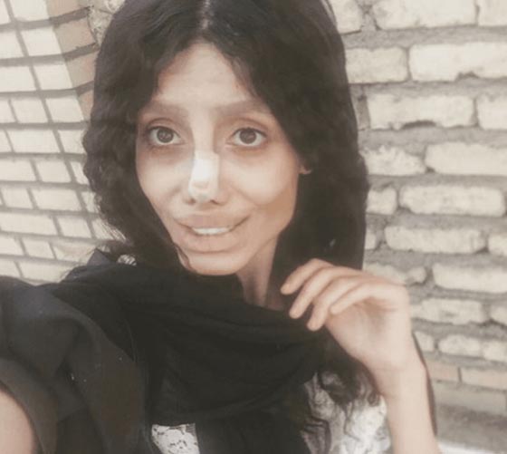سحر تبر الإيرانية شبيهة انجلينا جولي تكشف سر ال50 عملية تجميل! صورة رقم 10 سحر تبر الإيرانية شبيهة انجلينا جولي تكشف سر ال50 عملية تجميل! صورة رقم 10