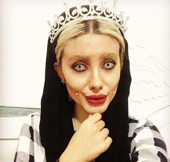 سحر تبر الإيرانية شبيهة انجلينا جولي تكشف سر ال50 عملية تجميل! صورة رقم 12 سحر تبر الإيرانية شبيهة انجلينا جولي تكشف سر ال50 عملية تجميل! صورة رقم 12