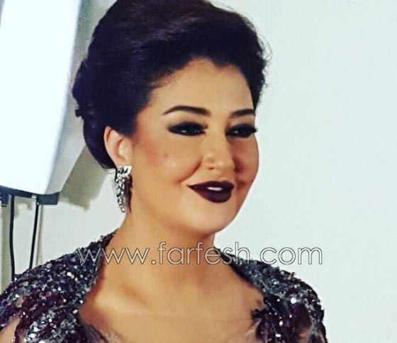 عمليات تجميل فاشلة شوهت الفنانات العربيات بينهن يسرا، غادة وكارمن صورة رقم 1
