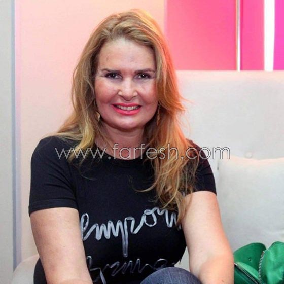 عمليات تجميل فاشلة شوهت الفنانات العربيات بينهن يسرا، غادة وكارمن صورة رقم 3