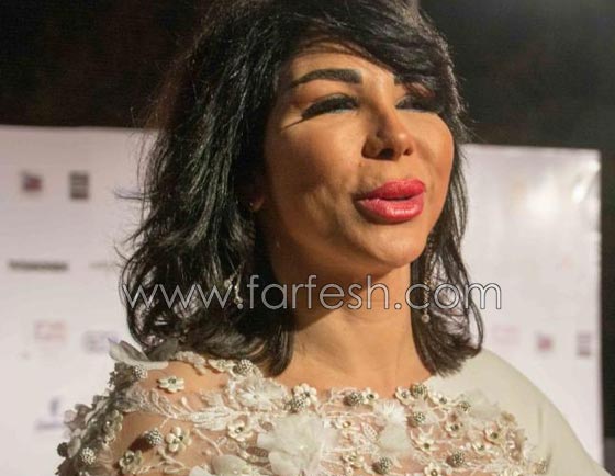 عمليات تجميل فاشلة شوهت الفنانات العربيات بينهن يسرا، غادة وكارمن صورة رقم 8
