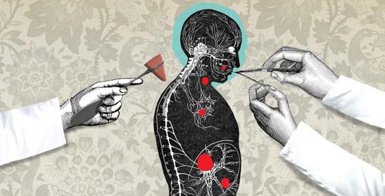 9 امراض نفسية تمنح المصابين بها ذكاء وقدرات خارقة صورة رقم 3 9 امراض نفسية تمنح المصابين بها ذكاء وقدرات خارقة صورة رقم 3