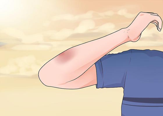 صحيح أم خطأ..  أشهر المعتقدات الشائعة عن مرض السرطان  صورة رقم 5