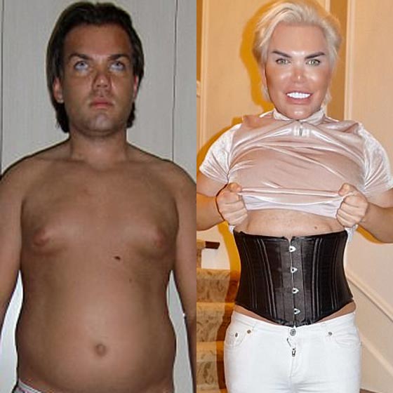 جنون الرجال: أجرى 60 عملية تجميل وأزال 12 ضلعا ليصبح شبه الدمية 