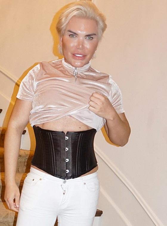 جنون الرجال: أجرى 60 عملية تجميل وأزال 12 ضلعا ليصبح شبه الدمية 