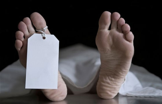 هل ينمو فعلاً الشعر والأظافر بعد الموت؟ صورة رقم 1