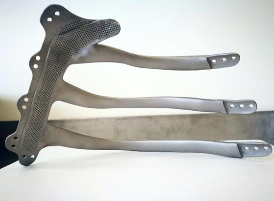 أول بريطاني يحصل على قفص صدري مطبوع بتقنية 3D! صورة رقم 5