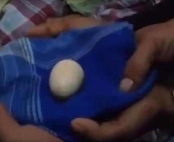 صدق او لا تصدق.. صبي يبيض كالدجاج  صورة رقم 4