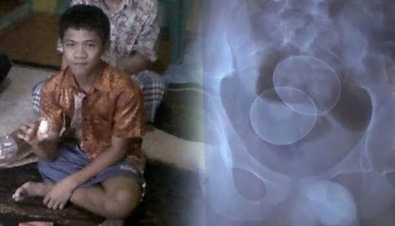 صدق او لا تصدق.. صبي يبيض كالدجاج  صورة رقم 1