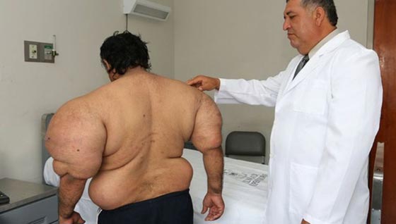 انتفاخ جسم غواص بشكل غريب في حادثة غامضة صورة رقم 2