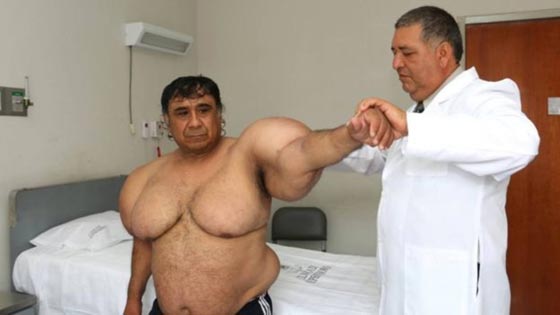 انتفاخ جسم غواص بشكل غريب في حادثة غامضة صورة رقم 1