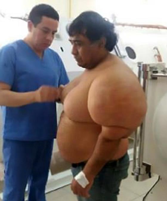 انتفاخ جسم غواص بشكل غريب في حادثة غامضة صورة رقم 9