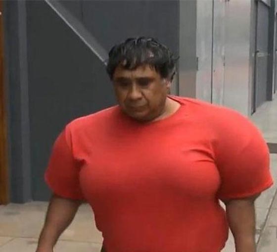 انتفاخ جسم غواص بشكل غريب في حادثة غامضة صورة رقم 10