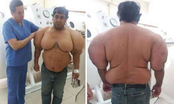 انتفاخ جسم غواص بشكل غريب في حادثة غامضة صورة رقم 11
