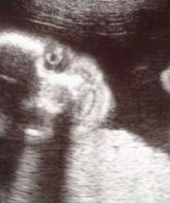 صورة غريبة لجنين داخل رحم أمه  صورة رقم 4