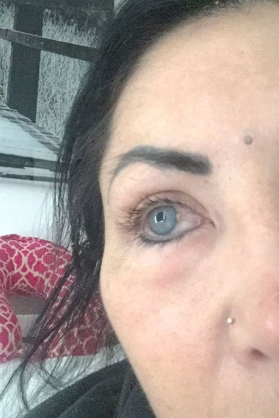 بالصور.. نجمة إنستغرام تصاب بالعمى بسبب تغيير لون عينيها صورة رقم 7