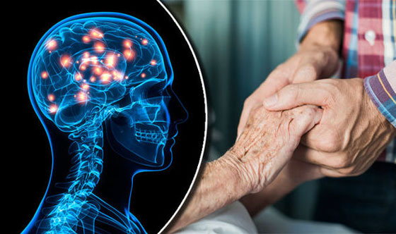 هذه الأمراض تؤثر على الشخصية.. تعرفوا عليها صورة رقم 2