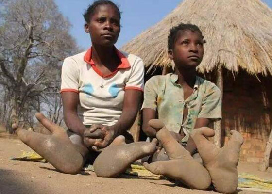 بالصور..13 قبيلة من أغرب الشعوب على وجه الأرض صورة رقم 13 بالصور..13 قبيلة من أغرب الشعوب على وجه الأرض صورة رقم 13