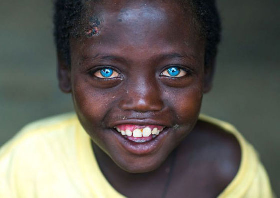 بالصور.. تعرفوا الى أجمل عيون في العالم صورة رقم 12